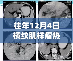 揭秘最新横纹肌样瘤治疗技术，革命性突破引领治疗新时代