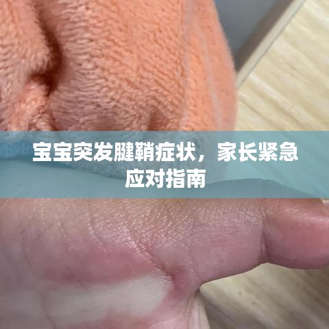 宝宝突发腱鞘症状，家长紧急应对指南