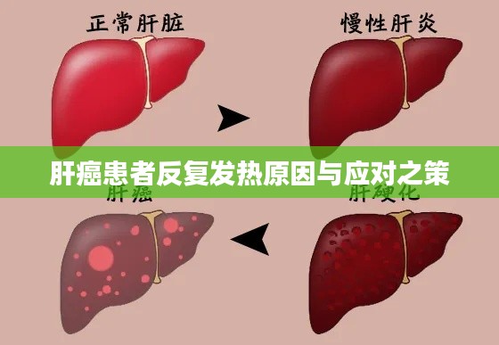肝癌患者反复发热原因与应对之策