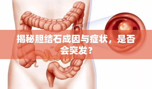 揭秘胆结石成因与症状，是否会突发？